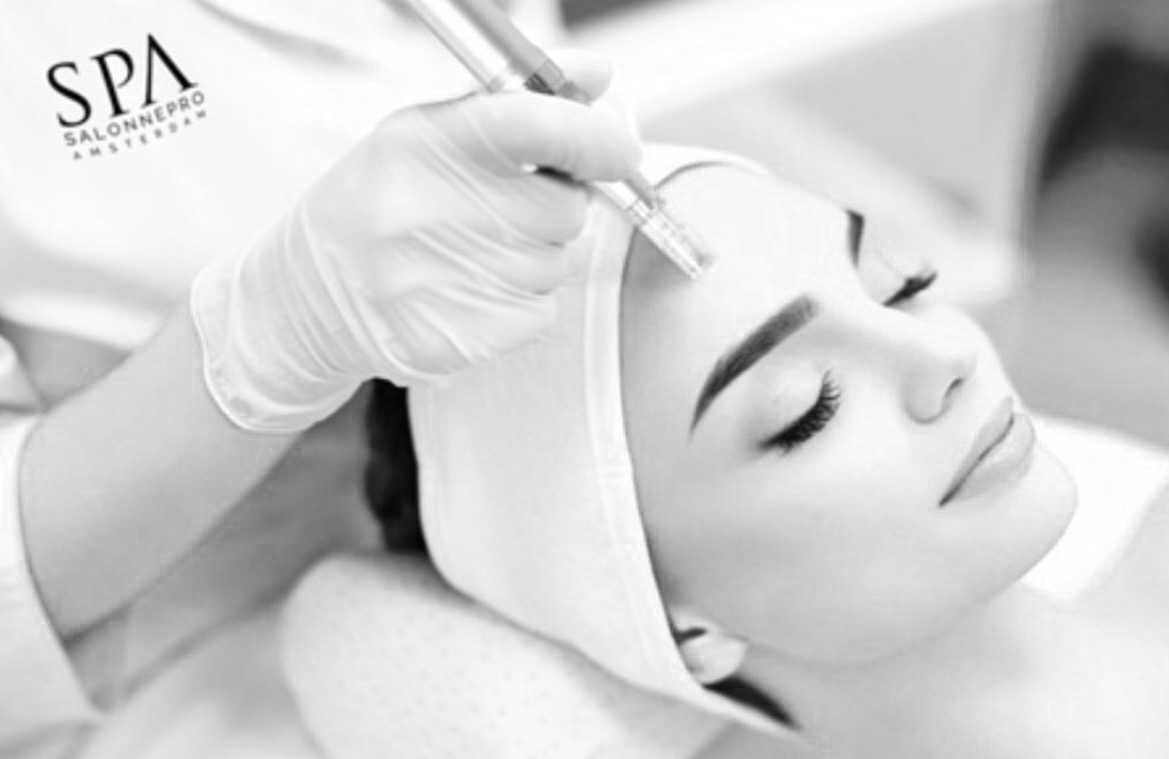 Microneedling